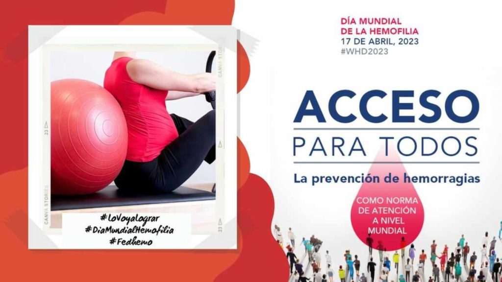 Acceso para todos